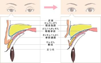 据史料记载 盛唐时期 上睑下垂 上睑下垂-病理诱因，上睑下垂-史料记载