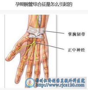 宫颈疾病的发病原因 腕管综合征 腕管综合征-疾病简介，腕管综合征-发病原因