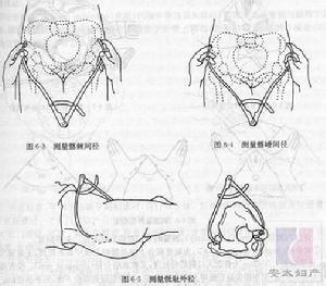 骨盆测量 骨盆外测量 骨盆外测量-测量目的，骨盆外测量-方法及程序