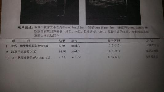 乔本氏甲状腺炎 乔本氏甲状腺炎 乔本氏甲状腺炎-疾病概述，乔本氏甲状腺炎-疾病