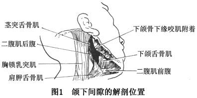 支原体感染病因 口底多间隙感染 口底多间隙感染-治疗措施，口底多间隙感染-病因