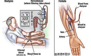 水中毒表现 水中毒 水中毒-病因，水中毒-临床表现