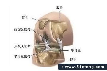 胫骨粗隆是哪个位置 胫骨粗隆