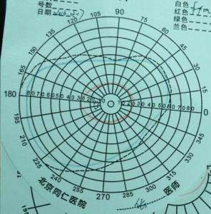 f0值的概念及意义 视域 视域-概念，视域-意义