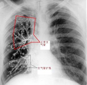 支气管扩张剂 支气管扩张剂 支气管扩张剂-基本信息