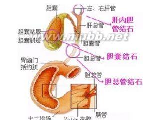 胆石症 胆石症 胆石症-概述，胆石症-流行病学