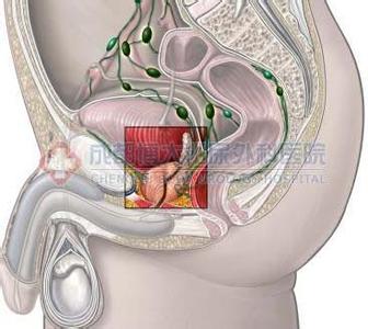 细菌性前列腺炎病因 非细菌性前列腺炎 非细菌性前列腺炎-病因，非细菌性前列腺炎-检
