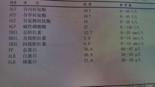 肝功能五项怎么看 肝功五项 肝功五项-肝功五项，肝功五项-肝功五项检查怎么看结果