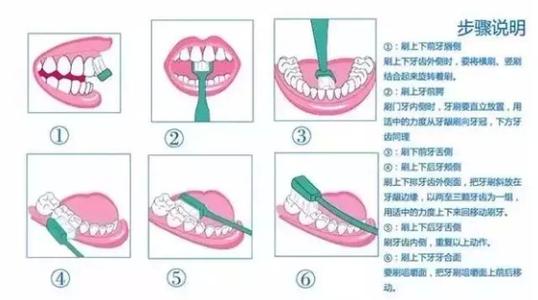 刷牙的正确方法 刷牙的正确方法有哪些