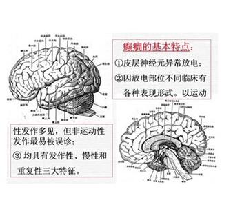 猪呼吸道疾病综合征 腹型癫痫综合征 腹型癫痫综合征-疾病概述，腹型癫痫综合征-疾病