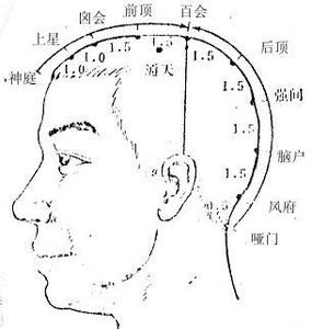 神庭穴是在哪个位置 神庭穴 神庭穴-定位，神庭穴-经属