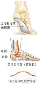 扁平足的矫正方法图解 扁平足的矫正方法