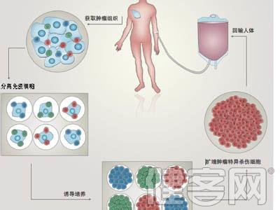 体细胞 体细胞治疗乙肝 体细胞治疗乙肝-概述，体细胞治疗乙肝-揭假