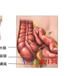 男性阑尾炎在那边 阑尾炎在哪边？