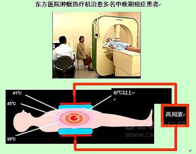 肿瘤热疗 肿瘤热疗 肿瘤热疗-名称，肿瘤热疗-方式