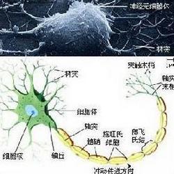 多发性神经纤维瘤 多发性神经炎 多发性神经炎-基本概述，多发性神经炎-类型