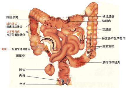 消化系统疾病 消化系统疾病 消化系统疾病-病史，消化系统疾病-体征