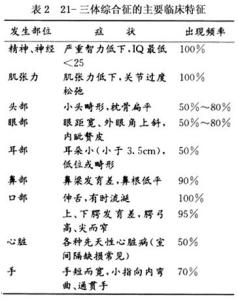 18体三体综合症原因 18三体综合症 18三体综合症-原因，18三体综合症-临床表现