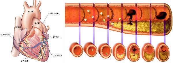 计算机科学基本定义 搭桥 搭桥-定义，搭桥-基本内容