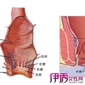 肛门出血检查 肛门出血 肛门出血-肛门出血的表现，肛门出血-检查