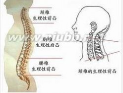 心脑血管疾病高发人群 腰椎康组合 腰椎康组合-腰椎疾病，腰椎康组合-高发人群