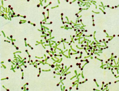 tetanus diphtheria