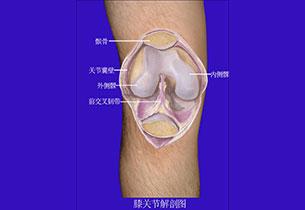 髌骨软化的临床表现 髌骨关节炎 髌骨关节炎-病因，髌骨关节炎-临床表现