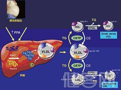 糖尿病病因和发病机制 酒精肝 酒精肝-病因，酒精肝-发病机制