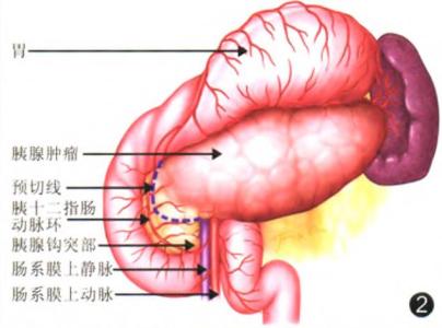 小鼠脾脏病理切片 脾切除 脾切除-病理，脾切除-脾脏生理