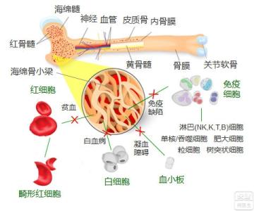 菌血症症状 菌血症 菌血症-病因，菌血症-症状和体征