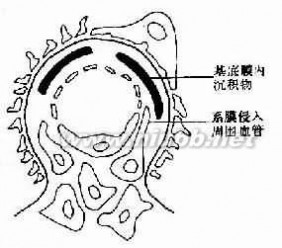 原发性高血压 原发性高血压-疾病概述，原发性高血压-分类