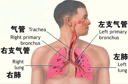 气管炎 气管炎-简介，气管炎-病情进展