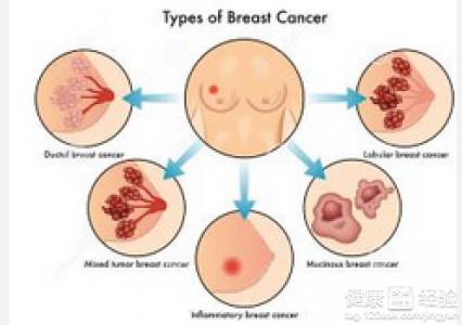 急性乳腺炎 急性乳腺炎-疾病简介，急性乳腺炎-病理原因