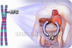 血色病 血色病-疾病描述，血色病-症状体征