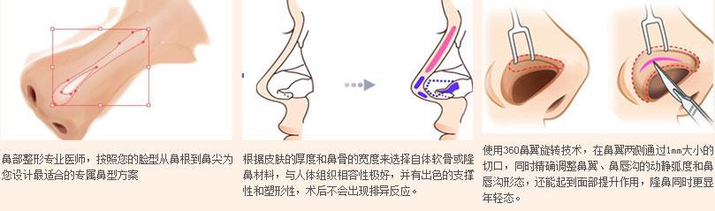 材料安全系数的选取 灵动水滴鼻 灵动水滴鼻-　　材料选取 ，灵动水滴鼻-　　特点