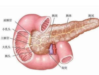 胰腺假囊肿 胰腺假囊肿-疾病概述，胰腺假囊肿-疾病诊断