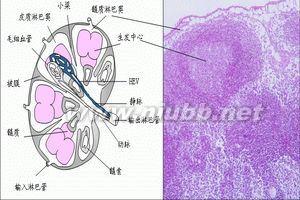 慢性颈淋巴结炎 慢性颈淋巴结炎-疾病概述，慢性颈淋巴结炎-临床