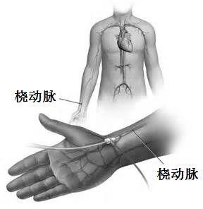 冠脉造影支架要多少钱 冠脉造影检查