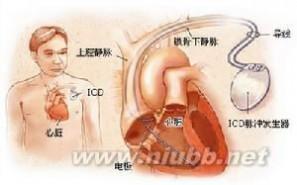 小肠疾病的症状和体征 窦性心动过速 窦性心动过速-症状体征，窦性心动过速-疾病病因