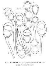 薄荷柄锈菌 野古草柄锈菌 野古草柄锈菌-野古草柄锈菌，野古草柄锈菌-形态描