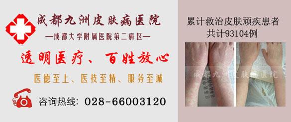 四川省皮肤病医院 四川省皮肤病医院-技术条件，四川省皮肤病医院