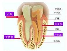 拔牙 拔牙-简介，拔牙-适应症