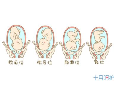 胎位不正 胎位不正-概述，胎位不正-分类