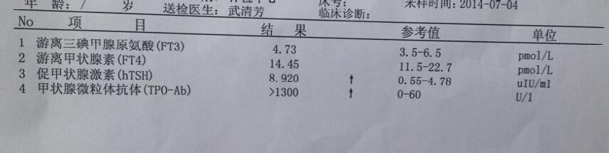 抗甲状腺微粒体抗体 抗甲状腺微粒体抗体-中文名称，抗甲状腺微粒