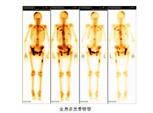 同位素检测方法 同位素检测