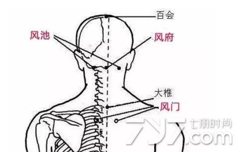 中暑刮痧 中暑刮痧刮哪些部位？夏季中暑的刮痧疗法