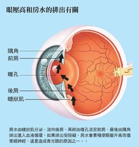 青光眼有哪些症状 青光眼是什么