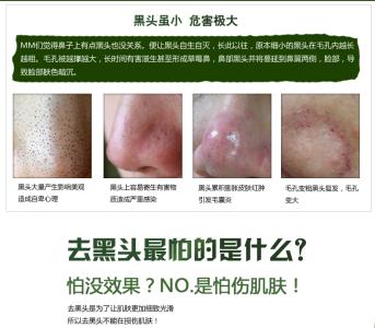 粉刺黑头毛孔粗大 粉刺黑头如何清光光？3招精准收毛孔