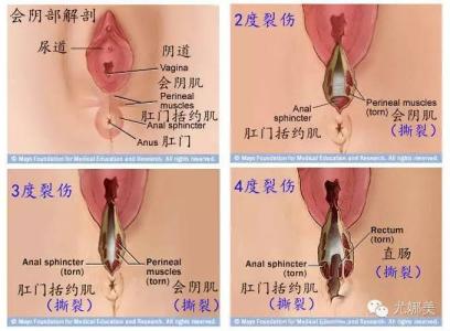 剖腹产恶露的颜色变化 剖腹产后恶露什么颜色