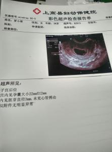 孕囊萎缩 孕囊萎缩后会重新长吗